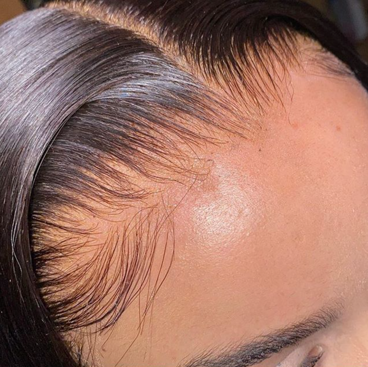 HD Frontals